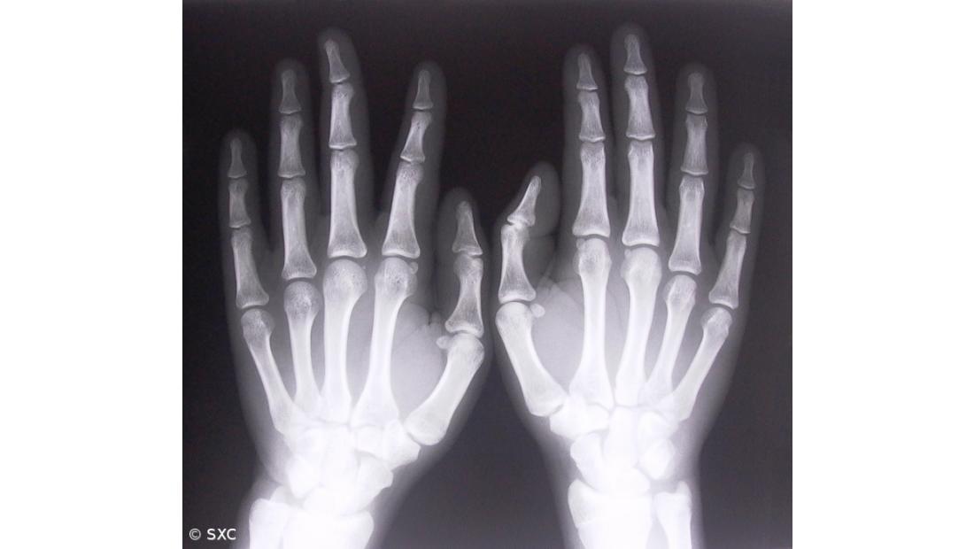 Técnicos de diagnóstico e terapêutica vão receber retroativos 