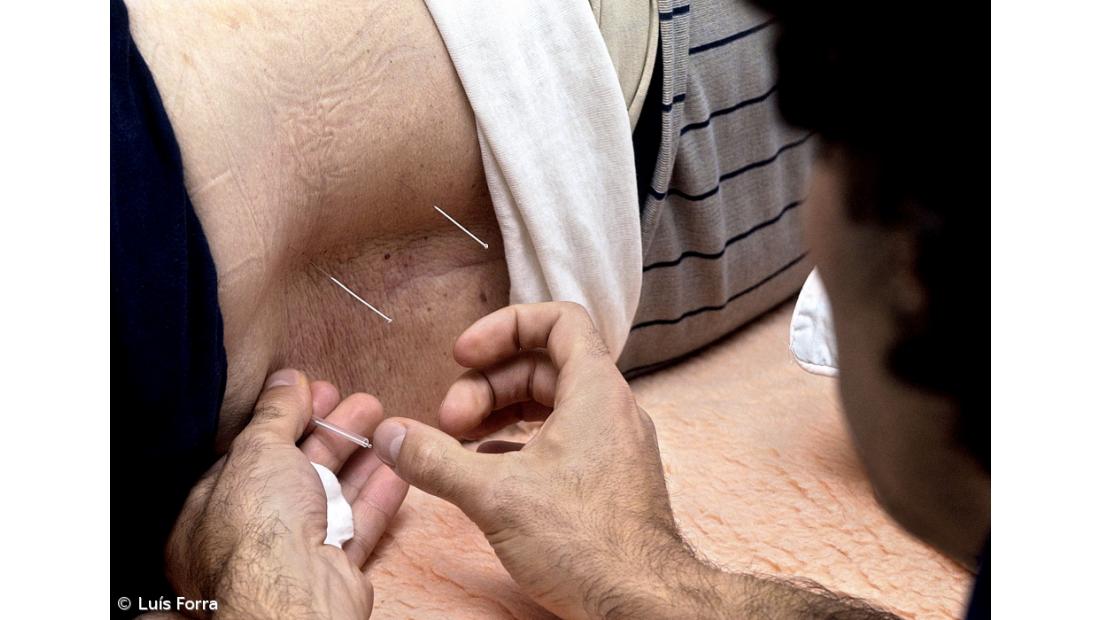 Portugal arrisca-se a ser único país europeu com licenciatura em medicina chinesa