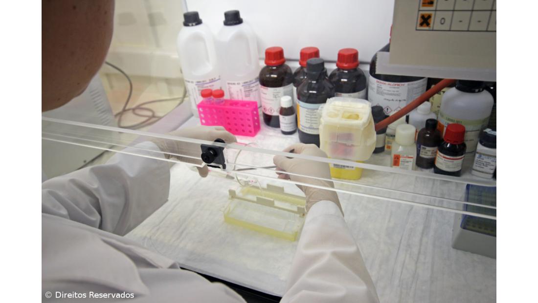 Investigadora portuguesa em projeto de 10ME que vai estudar doenças autoimunes