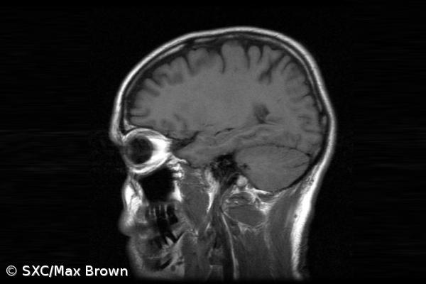 Teoria explica a relação entre complexidade cognitiva e assimetria cerebral – Imagem 1