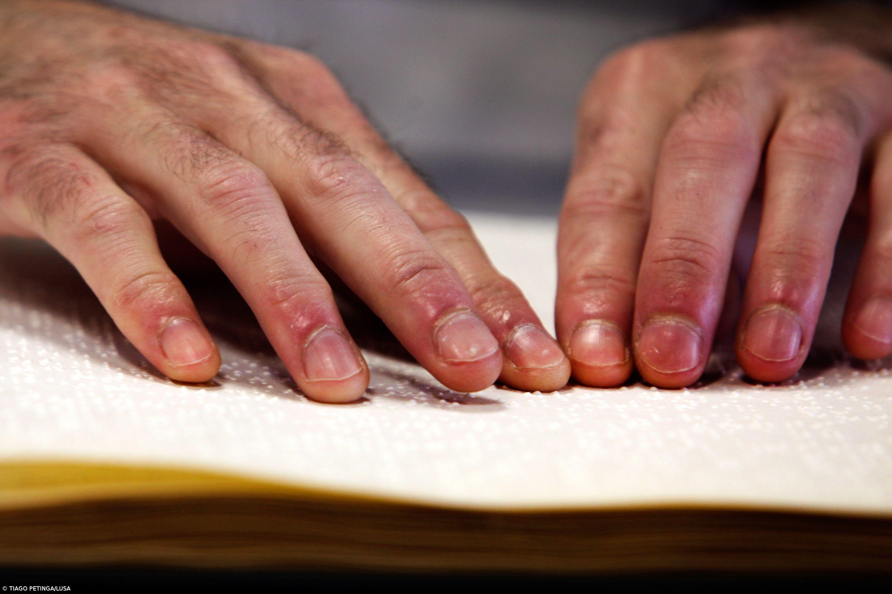 Contratação de deficientes na função pública vai ser revista, diz Governo – Imagem 1