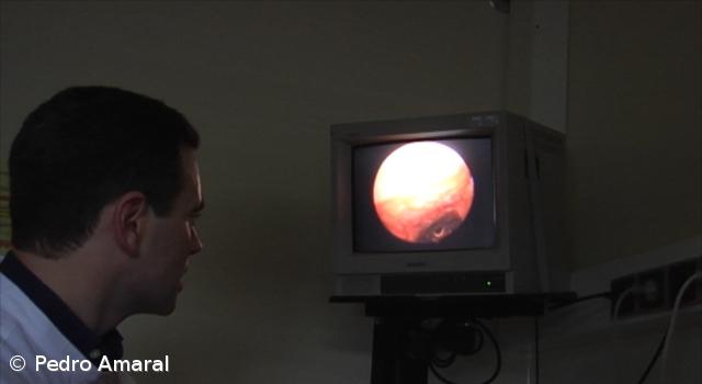 Detetados 130 novos casos por ano de cancro da mama nos Açores após introdução de rastreio – Imagem 1