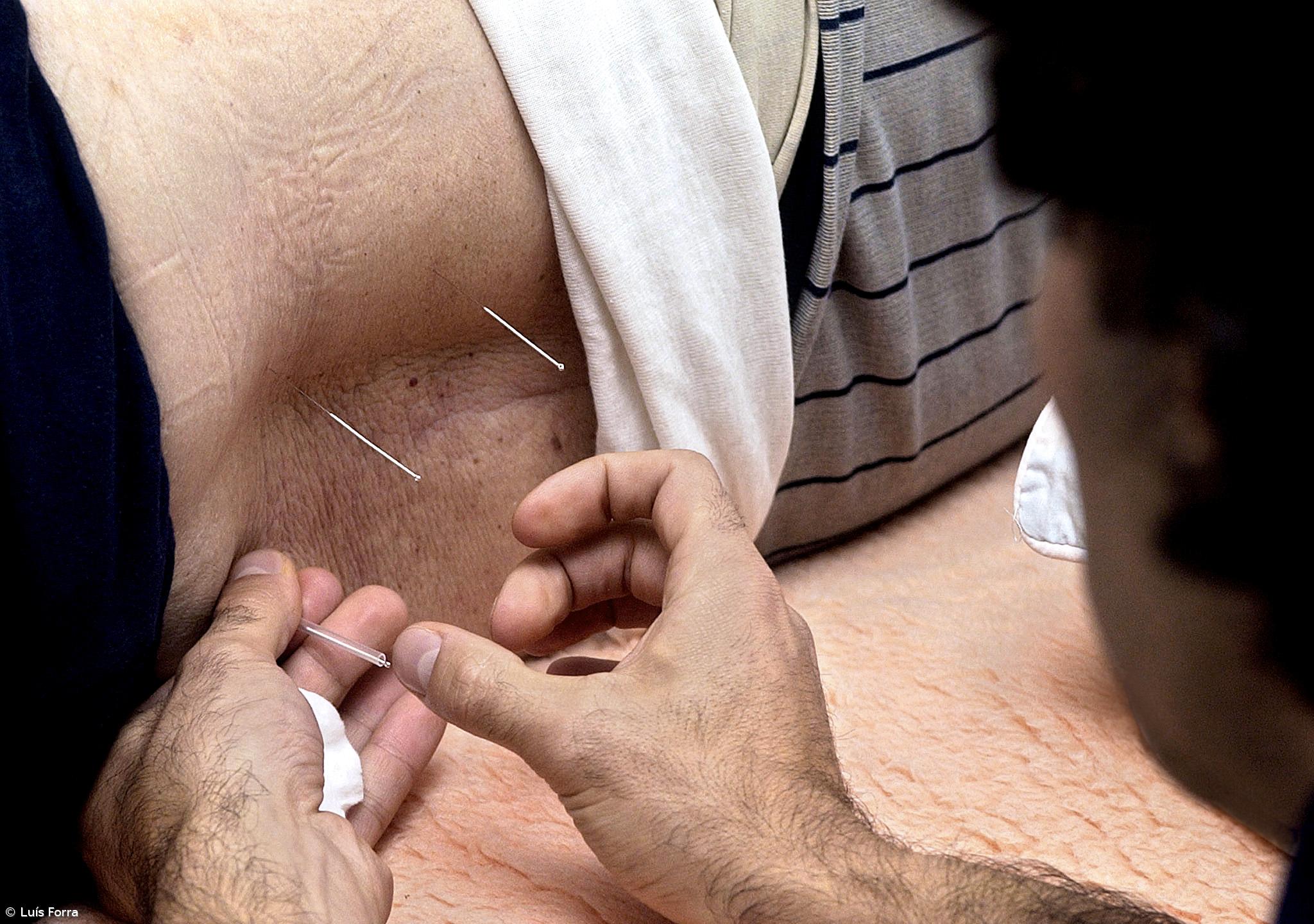 Portugal arrisca-se a ser único país europeu com licenciatura em medicina chinesa – Imagem 1