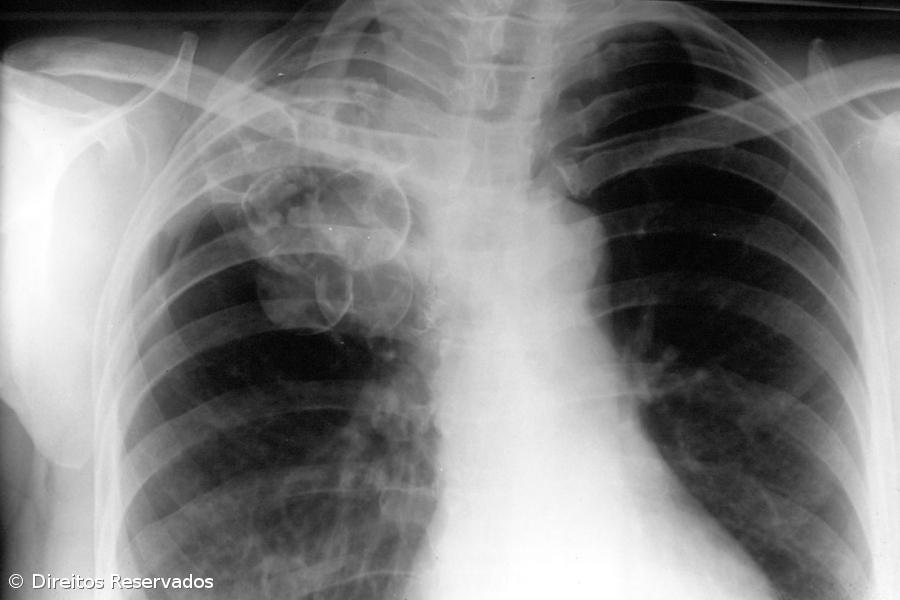 Governo Regional introduz prescrição eletrónica obrigatória de meios complementares de diagnóstico – Imagem 1