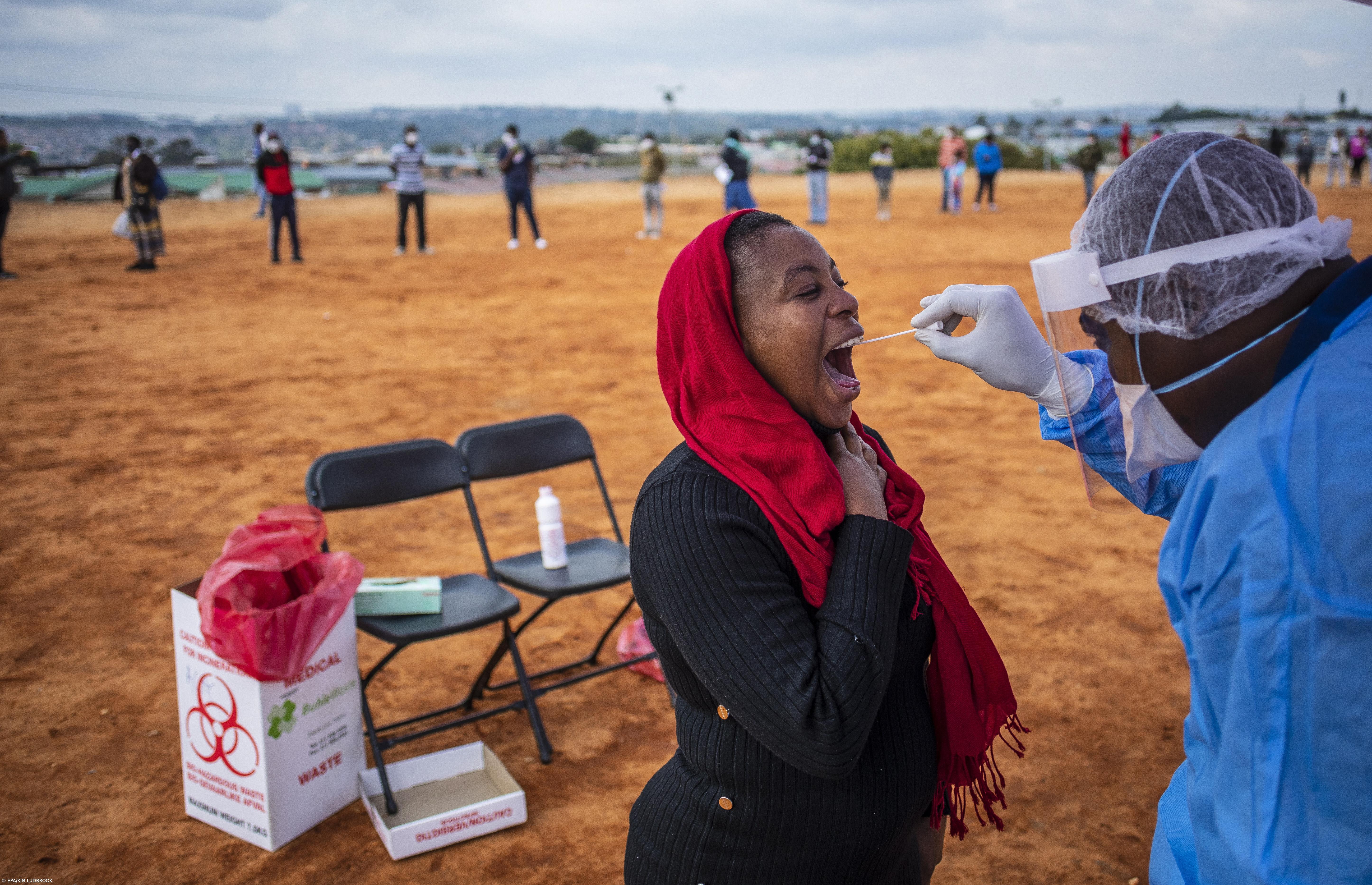 Número de mortos em África sobe para 15.600 em mais de 746 mil casos – Imagem 1