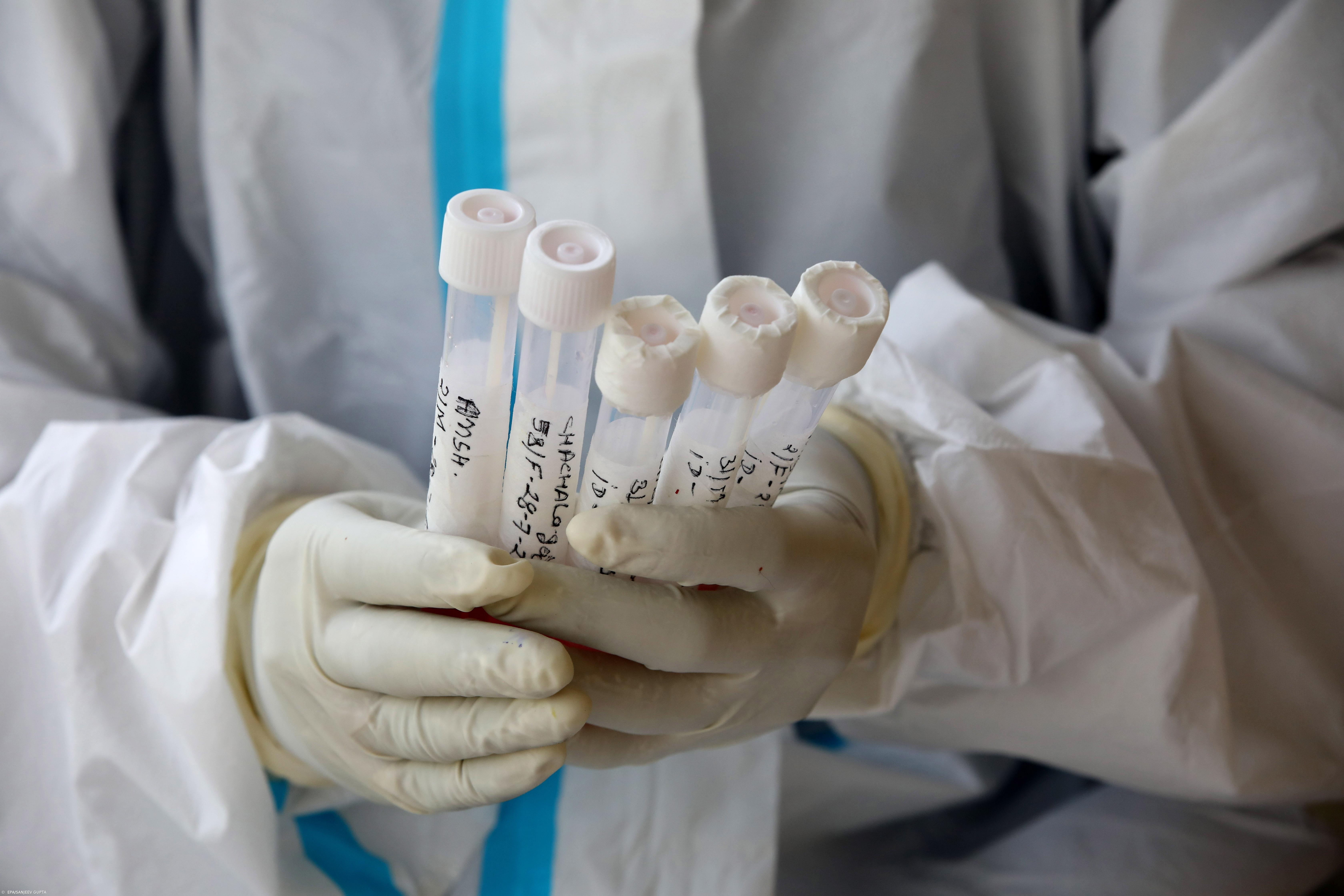 Grécia tem primeiro caso em campo de migrantes numa ilha do Mar Egeu – Imagem 1