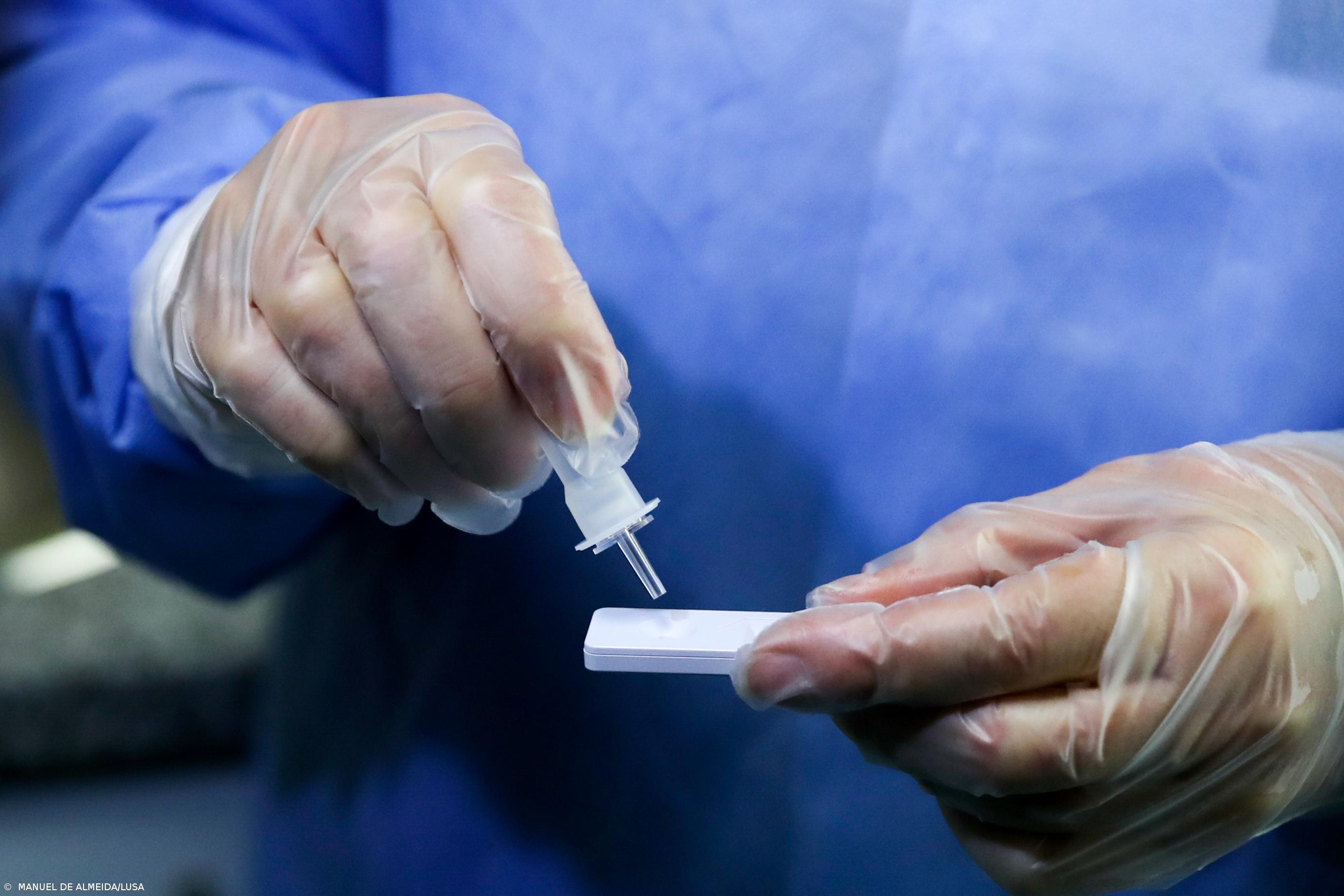 Açores com 239 novos casos de infeção por SARS-CoV-2 na última semana – Imagem 1