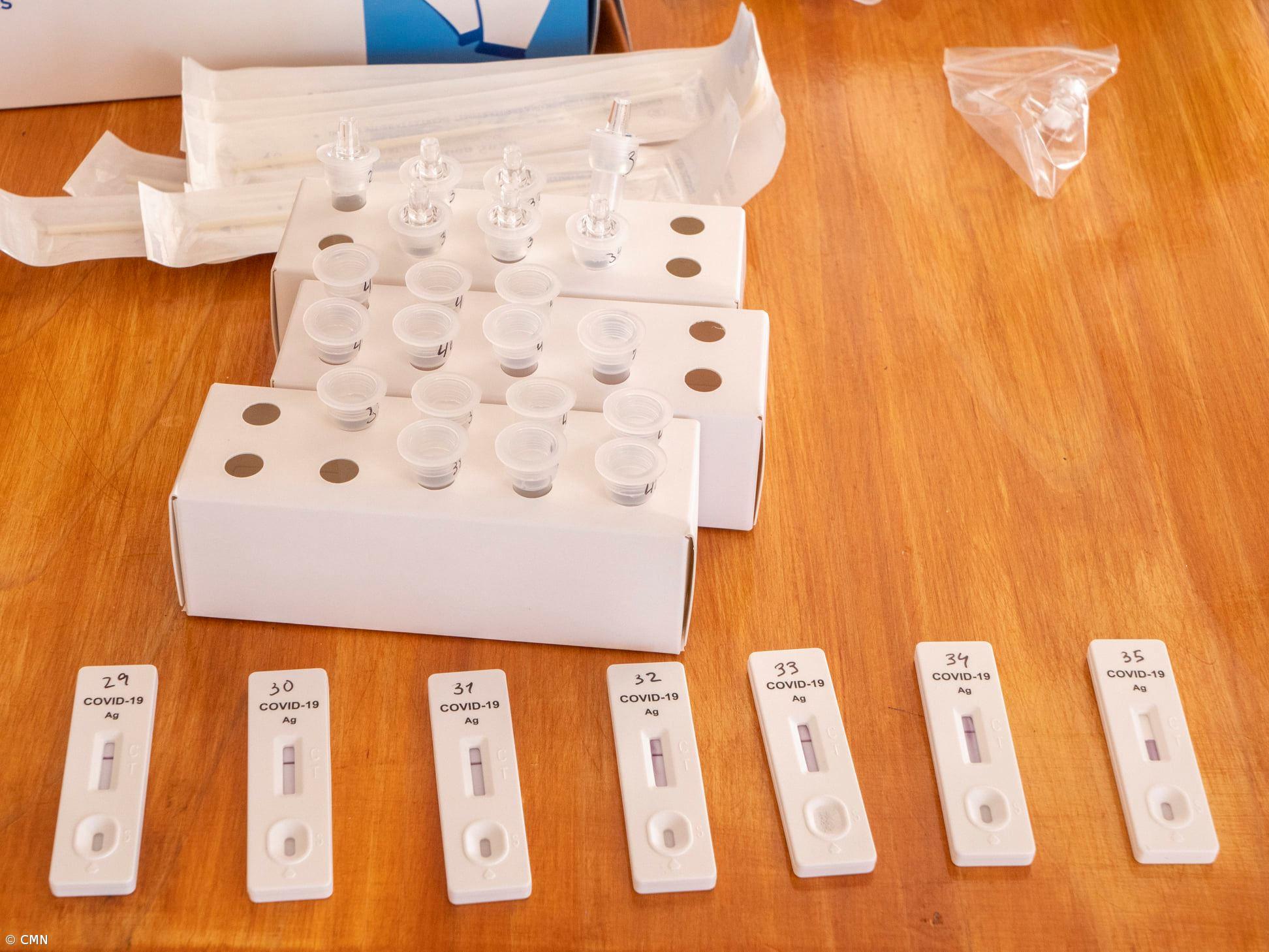 Câmara do Nordeste testa funcionários à Covid-19 – Imagem 1