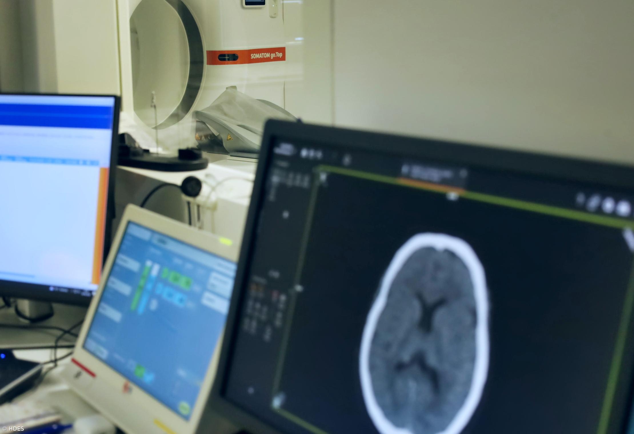 Hospital de Ponta Delgada trata AVC com tecnologia de inteligência artificial – Imagem 1