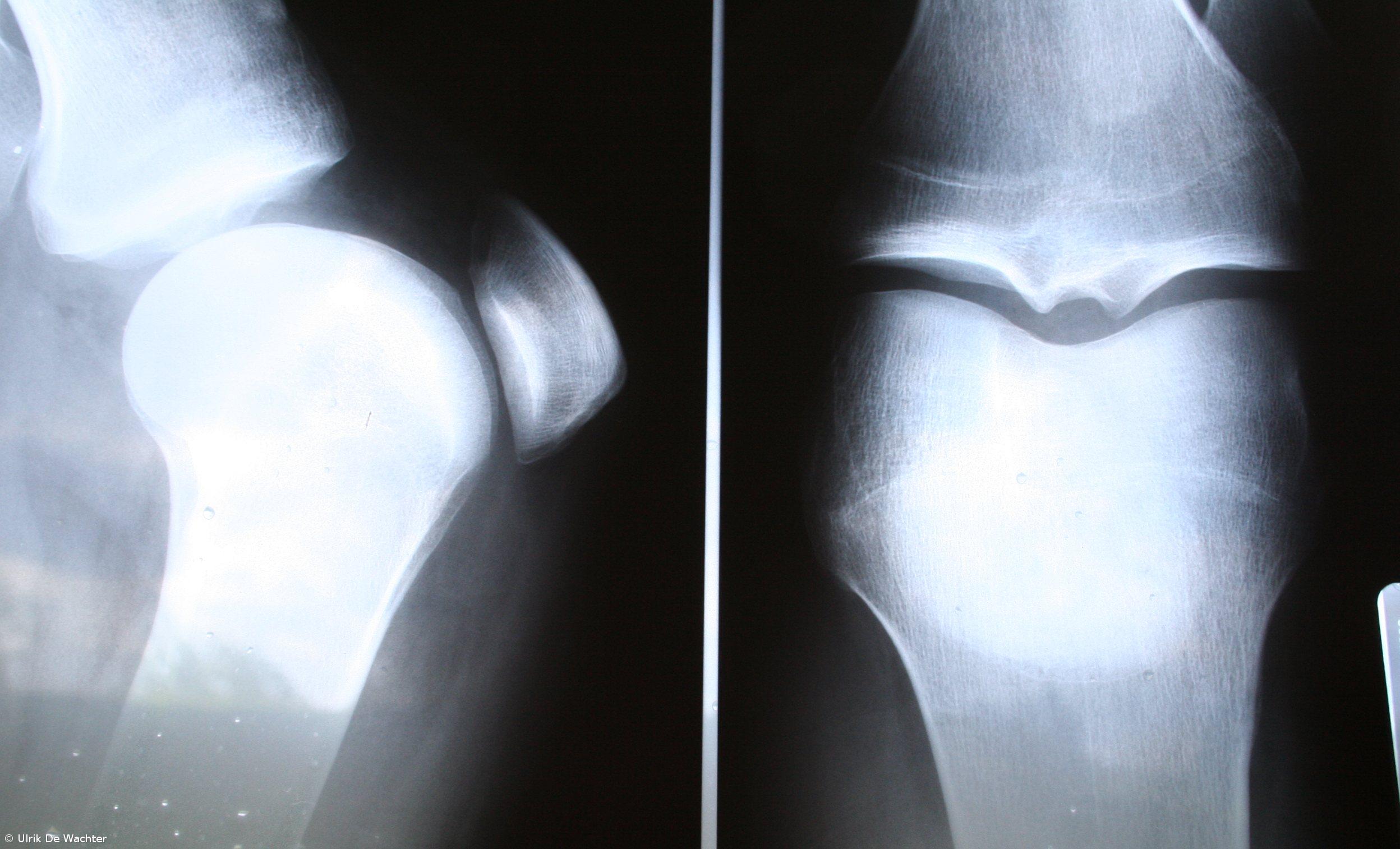 Um quarto dos portugueses sofre de problemas reumáticos – Imagem 1