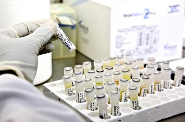 Faculdade de medicina do Porto reitera que primeiros casos de Candida auris em Portugal foram detetados em 2023