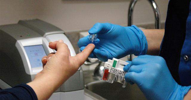 Cerca de 70 pessoas em prevenção do VIH no HDES