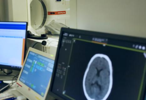 Hospital de Ponta Delgada trata AVC com tecnologia de inteligência artificial